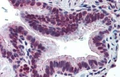 Immunohistochemistry-Paraffin: MUC13 Antibody [NBP3-14412]